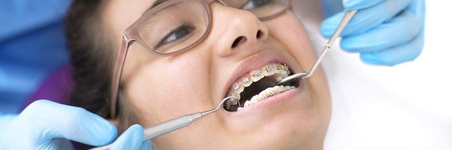 O que é Ortodontia? Conheça essa área da Odontologia!